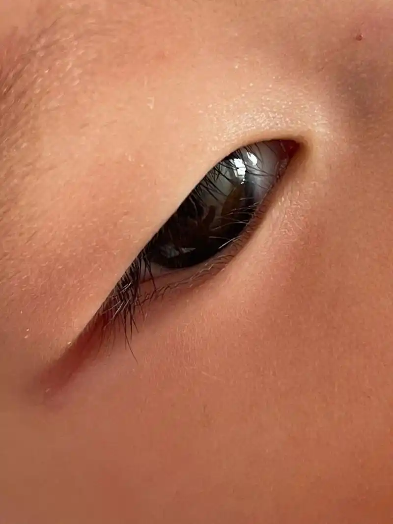 睫毛前半部分总是贴眼球上,导致她经常揉眼睛98,有没有同款的宝宝啊