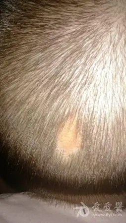 上图,请各位专家指教:  沙发回复老新闻2013-08-11 19:24:54是皮脂