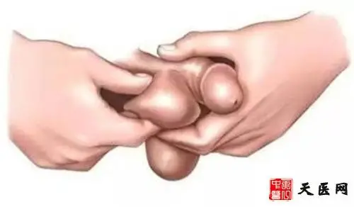 男性睾丸炎疾病会传染吗睾丸炎有什么特点