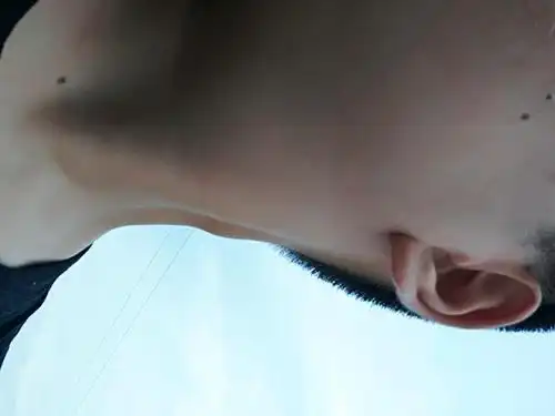 一扭脑袋就可以看到,摸起来硬的,不知道是啥,就是图片脖子突出那个