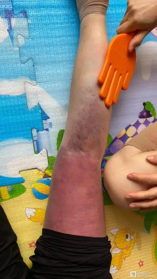 拍打改善脚掌麻木,胆经淤堵,揉脐治好了我多年的睡眠和便秘问题!