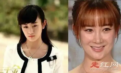 张檬整容记图片判若两人变化好大而且整残了