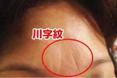 注意额头有竖纹对你的命运大有帮助