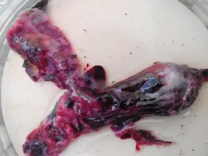 帮忙看这是孕囊排出物吗