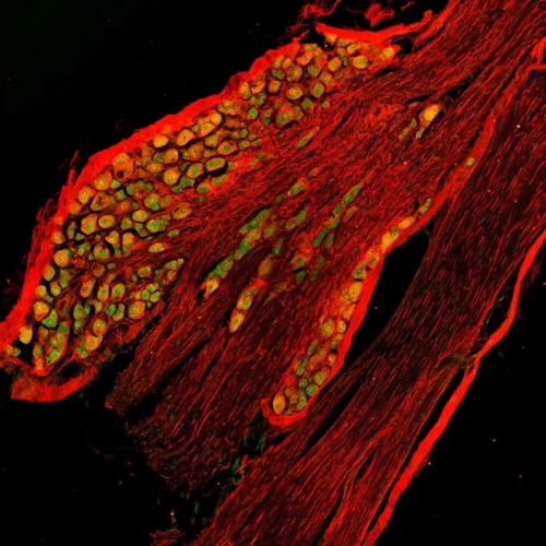 小鼠背根神经节背根神经节冰冻切片免疫荧光双染色,tuj1(红),utx(绿).