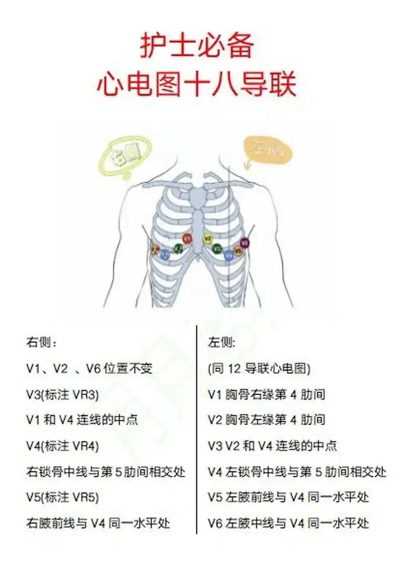 护士必备心电图十八导联