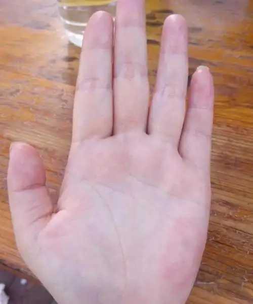 手相上的七中表现看身体健康状况