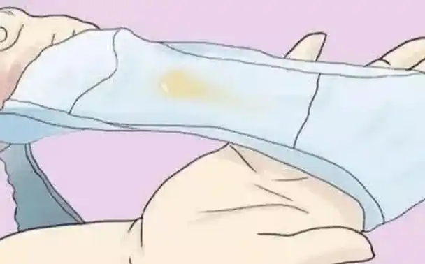 女性内裤上黄黄的分泌物是什么