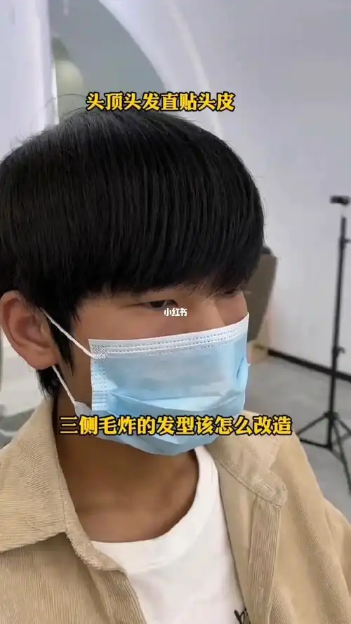 头顶扁塌头发直贴头皮的男生看过来