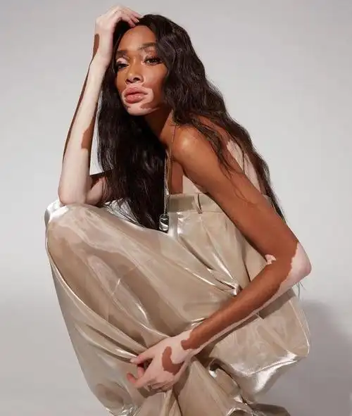 外表饱受非议内心成熟强大奶牛超模凭借自信闯出时尚路