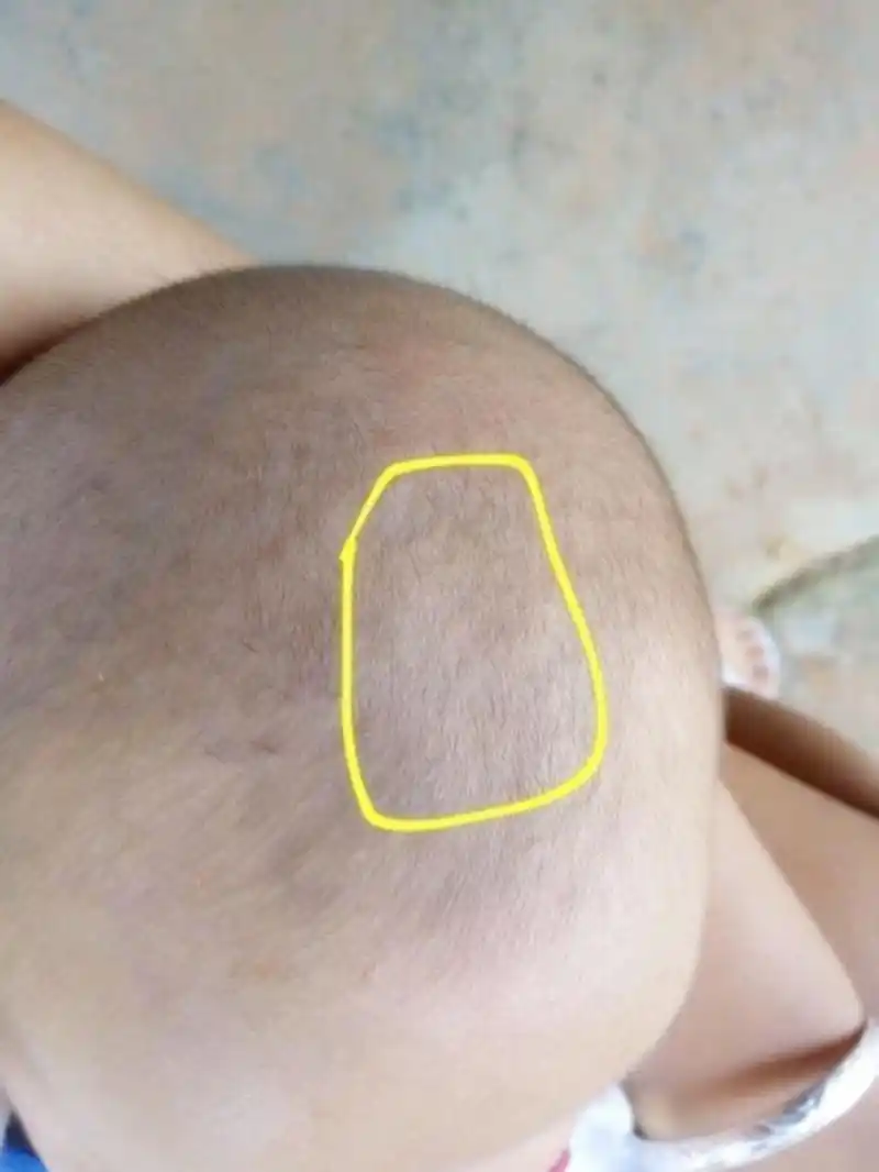 原创囟门什么时候闭合最合适太早或太晚都不行宝妈要注意