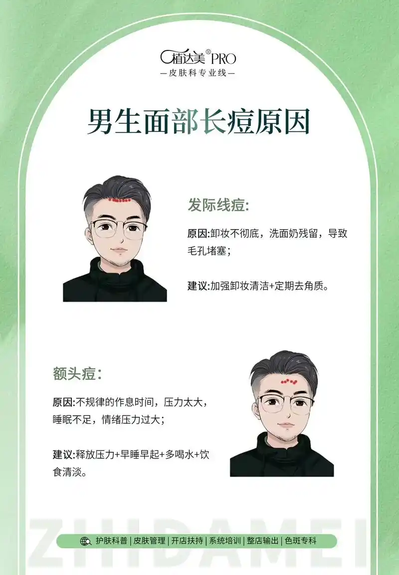 脸上各个部位长痘的原因及解析.脸上长痘,多少和护肤方式不当, - 抖音