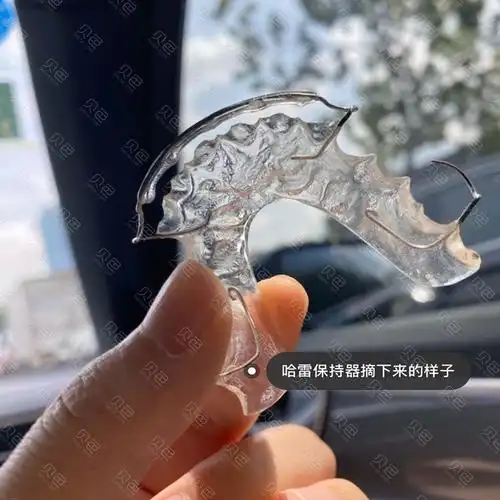 你以为摘了牙套就完全结束了哈雷保持器进来了解一下