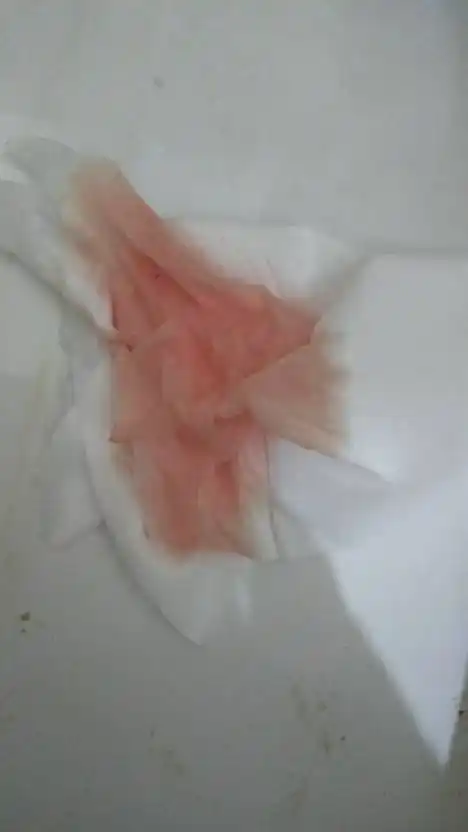 同房后尿频尿急尿血尿痛怎么回事,如果是想要小孩的情