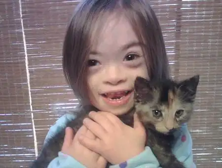 母亲:可怜的孩子,为什么?为什么你是一个唐氏综合症的孩子?