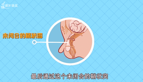 疝气不痛不痒有没有必要治外科专家告诉你答案