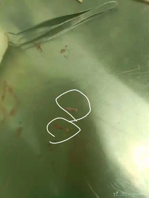 我做的是血瘀方向,想取大鼠腹主动脉做wb