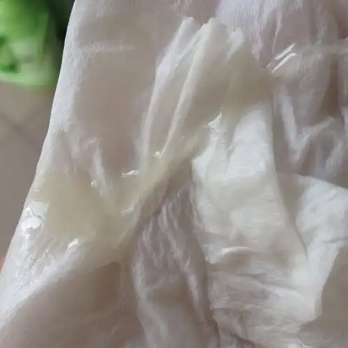 这种白带属于正常吗,谢谢