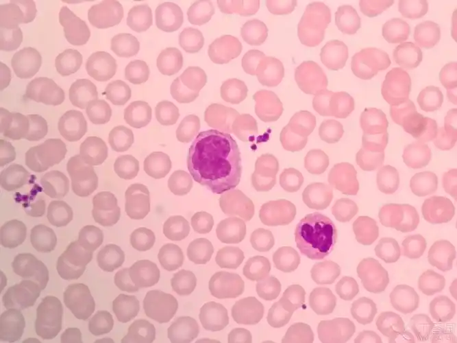 查看 扎手指,白细胞18,血小板四百多.