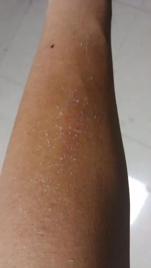 如图,有人知道什么原因吗?