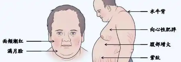 水牛背,是肩颈部位脂肪厚,肉多,明显鼓起来,形似水牛背.还出 - 抖音