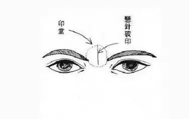 36知识 风水知识 八字纹面相印堂是指两眉之间的距离,在十二宫学中