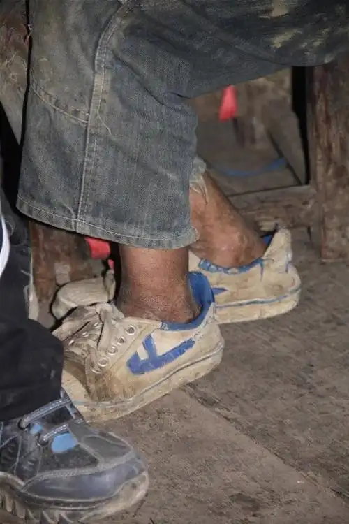 一个贫困家庭孩子的脚