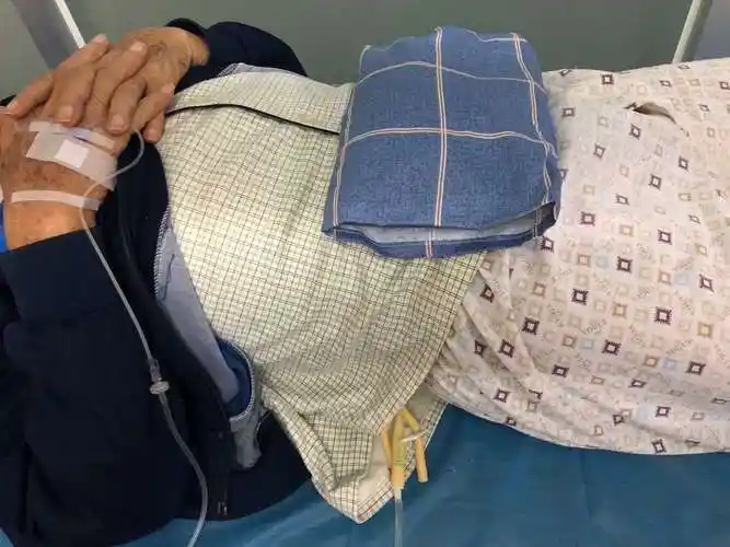 中医绿色疗法之中药热奄包