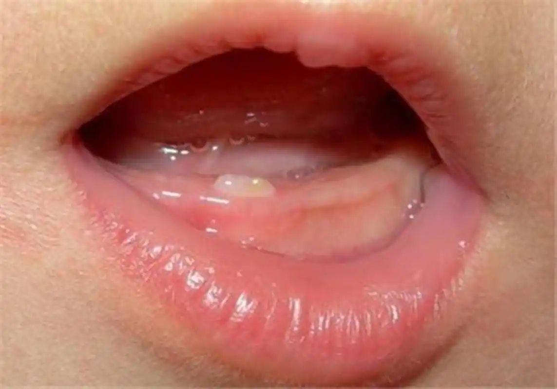 宝宝迟迟不长牙,宝妈不解心急如焚,这正常吗?