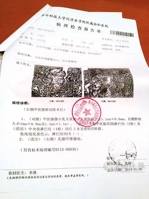 曝武汉协和医院放射污染 患癌女副教授求援方舟子