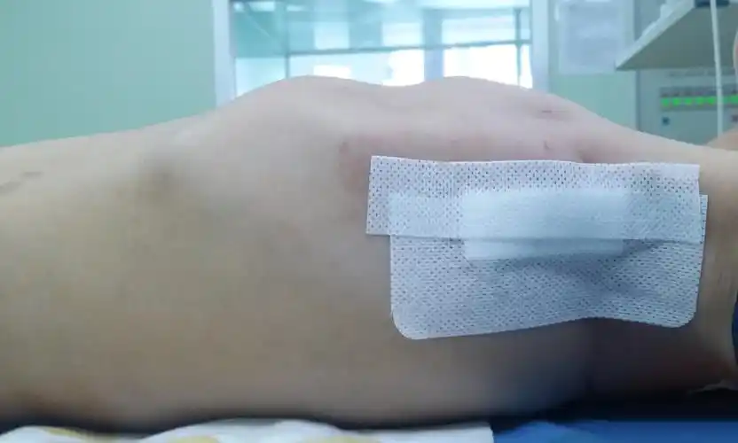 罕见肋骨畸形合并胸廓畸形手术成功