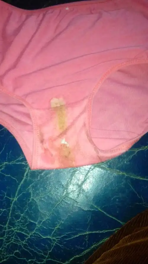 这内裤上黄的是什么