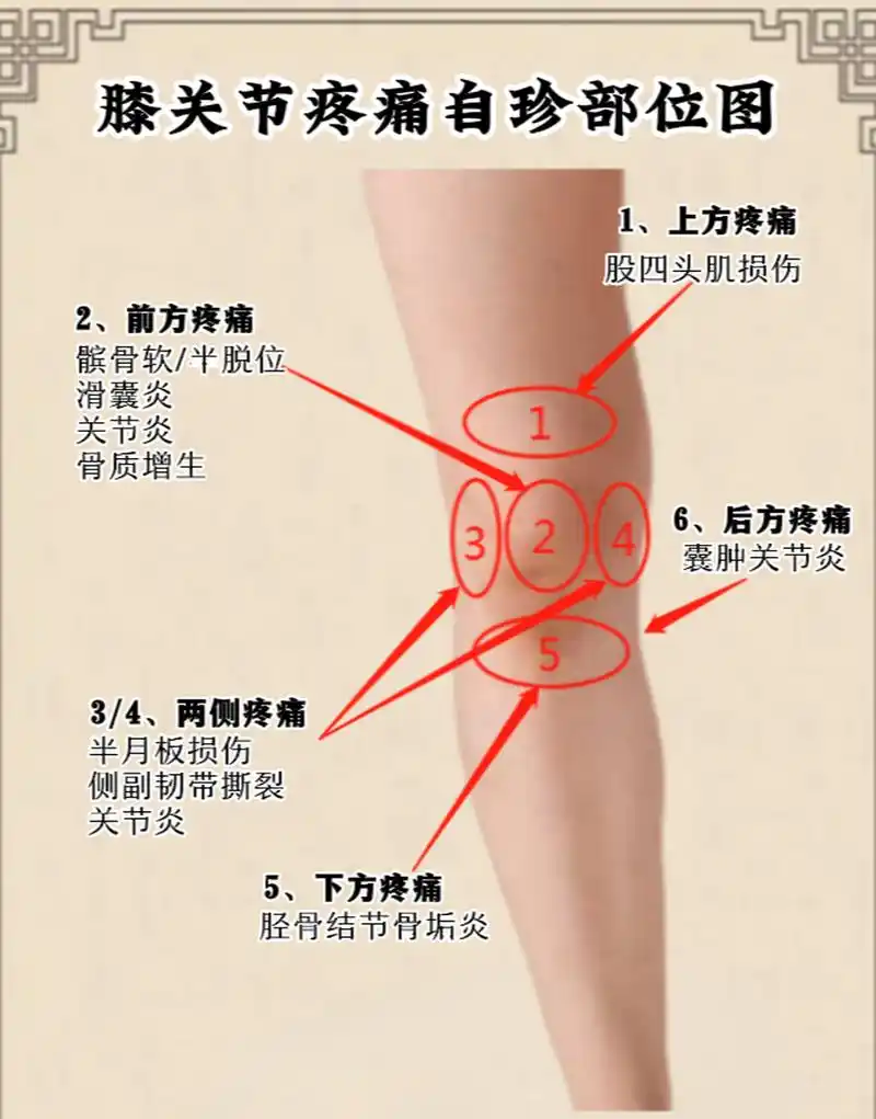 膝盖关节疼痛自诊与调理  1,上方疼痛:股四头肌损伤 2,前方疼痛:髌骨