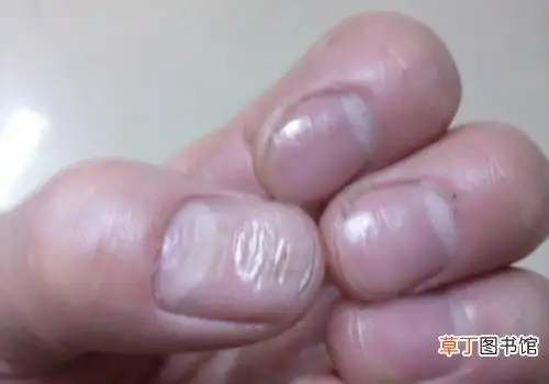 常见的疾病有气血虚亏症,肝血不足症,维生素a缺乏症,肝病,营养不良症