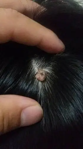 头上有个这样一个软疙瘩 很早就有了, 不知道这是什么呢?