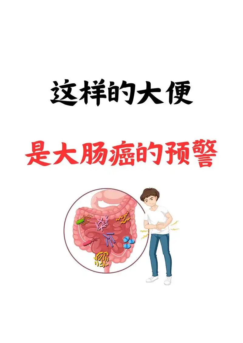 这样的大便,是大肠癌的预警.#肠癌 #科普健康知识 - 抖音