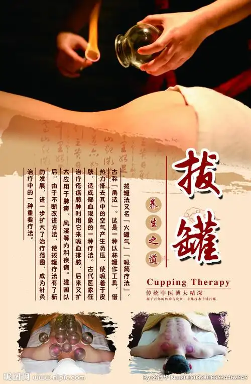 理疗拔罐设计图__海报设计_广告设计_设计图库_昵图网nipic.com