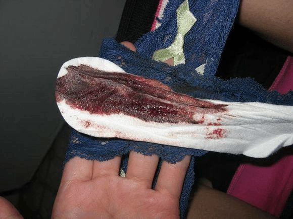 的宝宝出生话题了,今天和大家聊聊妈妈顺产后多久后来月经这个问题呢