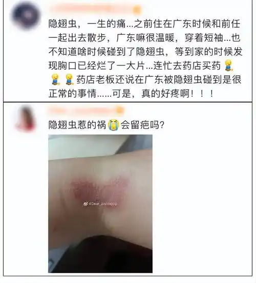 下隐翅虫皮炎就医后确诊为她的眼下就开始红肿疼痛结果没想到随后几天