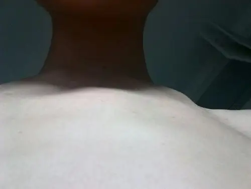 本人十四岁,初三,体型偏瘦,今天无意发现我的胸骨,请问我是不是鸡胸