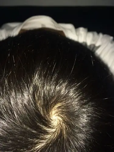 帮我分辨下头上的涡往那边旋.自己拍的