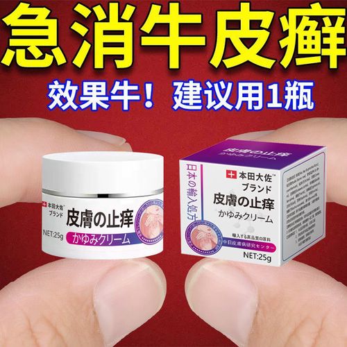 牛皮癣银屑病专用止痒膏头皮癣体股癣手足癣顽固性皮炎湿疹特效药