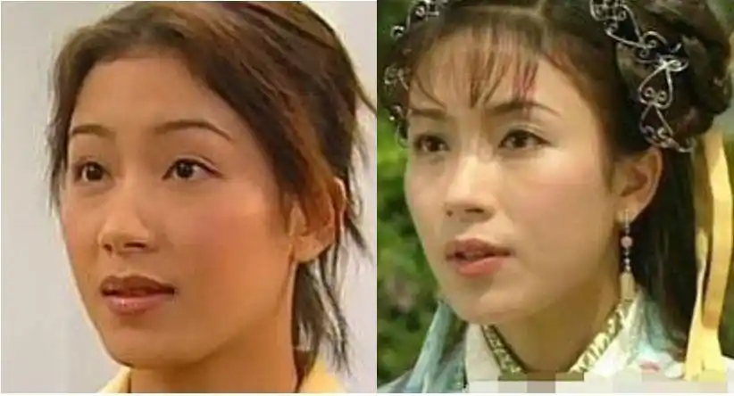 这位实力派女演员的新假体比木棍还粗|杨怡|假体|鼻子_新浪女性_新浪