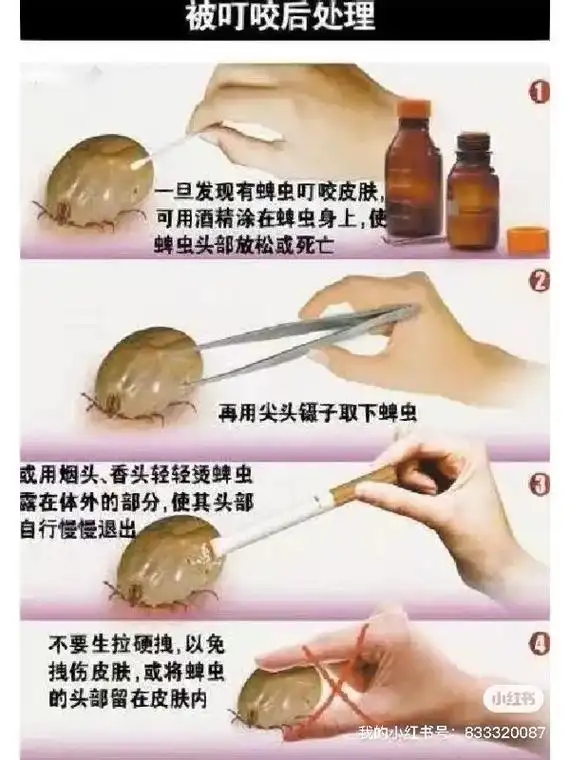 蜱虫怎么去除简单方法.1摘下蜱虫. 如果蜱虫咬住人或动物的皮 - 抖音
