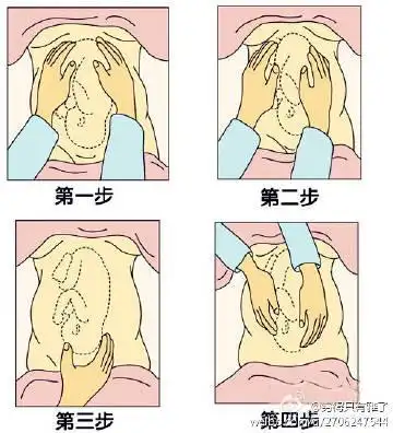 穷得只有雅了  产科四步触诊法.