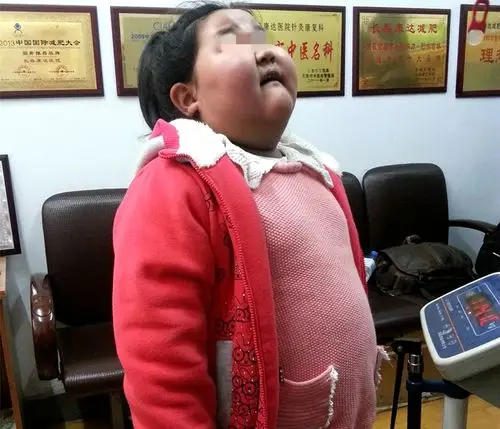 长春康达减肥医院肥胖病科于树忠主任介绍:1.