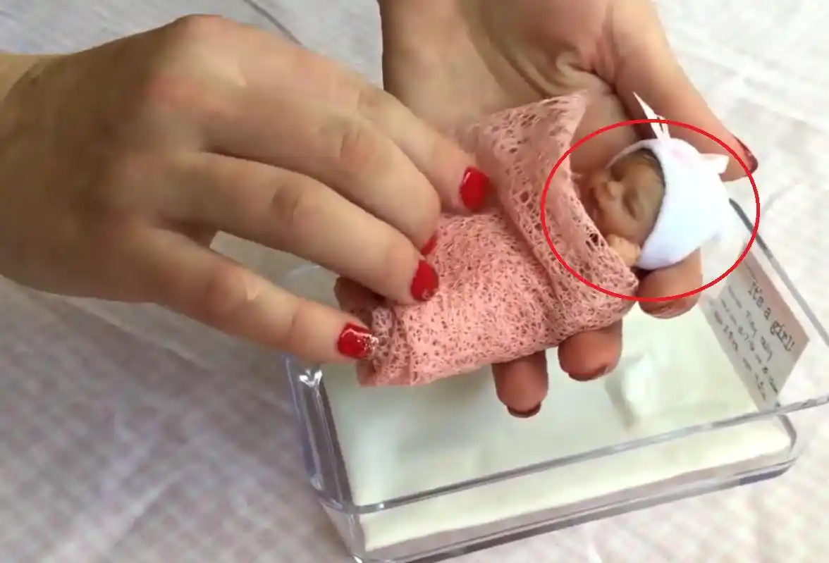 世界上"最小的婴儿",只有手掌心大小,看的人要萌化了