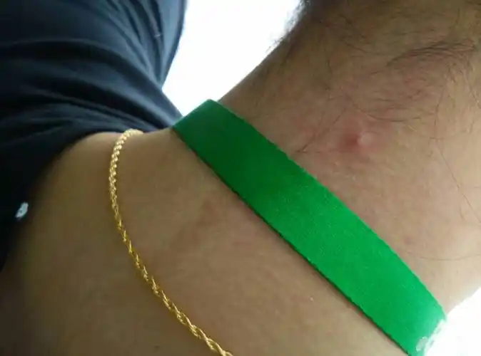 脖子后面有淋巴结么