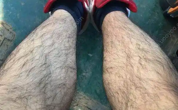 腿毛太多怎么办 腿毛太多怎么办男生