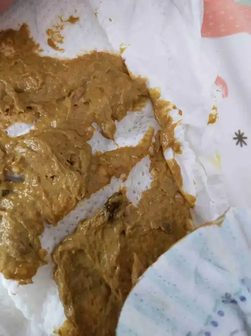2月的宝宝,拉的粑粑一粒咖啡色的一小粒是怎么回事呀?